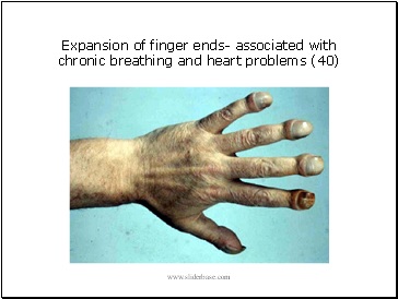 Expansion of finger ends- associated with chronic breathing and heart problems (40)