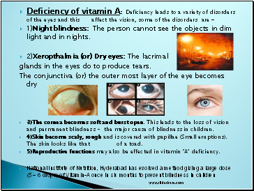 Deficiency of vitamin A: Deficiency leads to a variety of disorders of the eyes and this affect the vision, some of the disorders are 