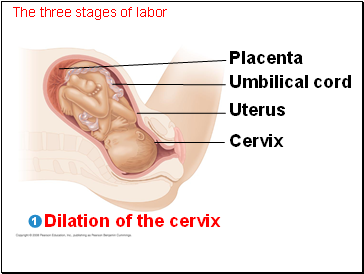 The three stages of labor