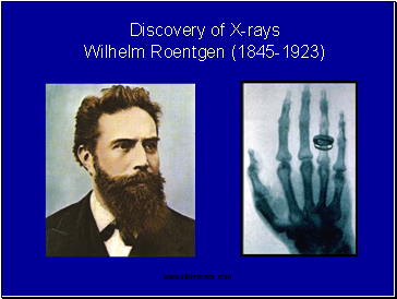 Discovery of X-rays Wilhelm Roentgen (1845-1923)