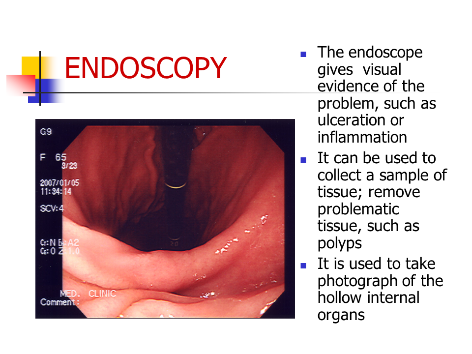 Endoscopy - Presentation Biology