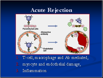 Acute Rejection