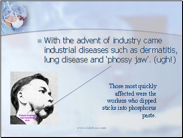 With the advent of industry came industrial diseases such as dermatitis, lung disease and phossy jaw. (ugh!)