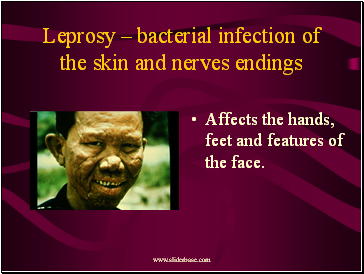 Leprosy  bacterial infection of the skin and nerves endings