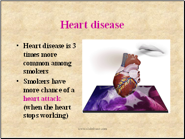 Heart disease