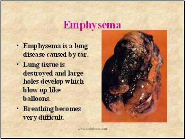 Emphysema