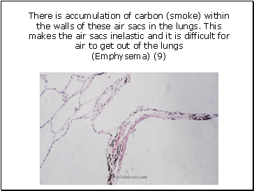 There is accumulation of carbon (smoke) within the walls of these air sacs in the lungs. This makes the air sacs inelastic and it is difficult for air to get out of the lungs (Emphysema) (9)