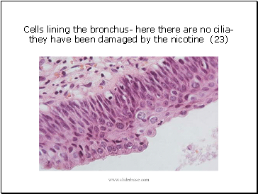 Cells lining the bronchus- here there are no cilia- they have been damaged by the nicotine (23)