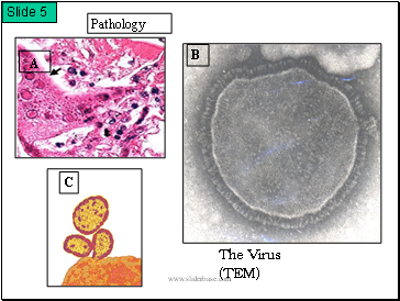 Pathology