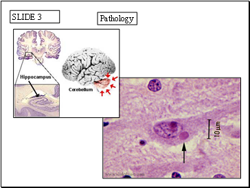 Pathology