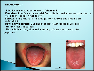 Riboflavin