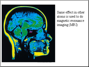 Same effect in other atoms is used to do magnetic resonance imaging (MRI)