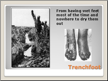 Trenchfoot