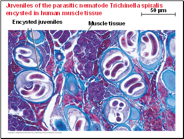 Juveniles of the parasitic nematode Trichinella spiralis encysted in human muscle tissue