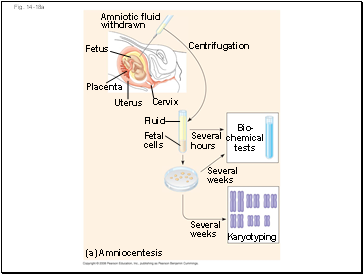 Fig. 14-18a