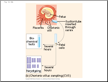 Fig. 14-18b