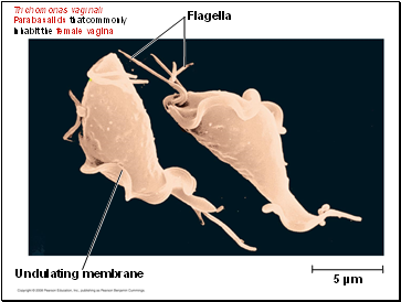 Trichomonas vaginali Parabasalids that commonly inhabit the female vagina