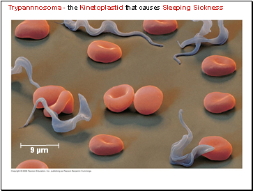 Trypannnosoma - the Kinetoplastid that causes Sleeping Sickness