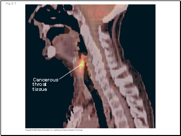 The ear conveys information about sound waves: