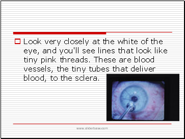 Look very closely at the white of the eye, and you'll see lines that look like tiny pink threads. These are blood vessels, the tiny tubes that deliver blood, to the sclera.