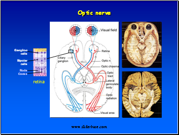 Optic nerve