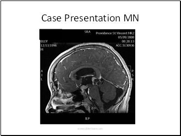 Case Presentation MN