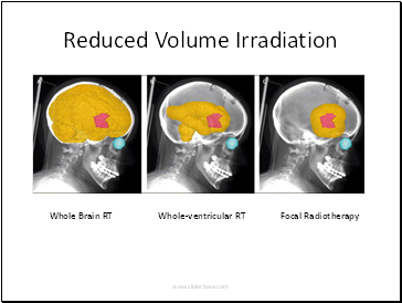Reduced Volume Irradiation