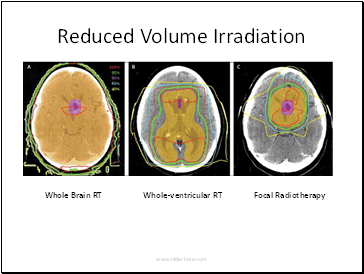 Reduced Volume Irradiation