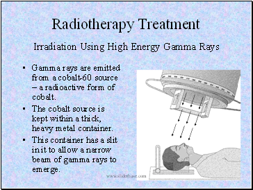 Radiotherapy Treatment