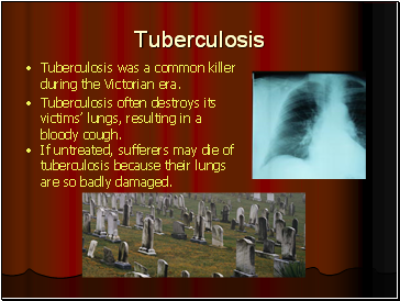 Tuberculosis