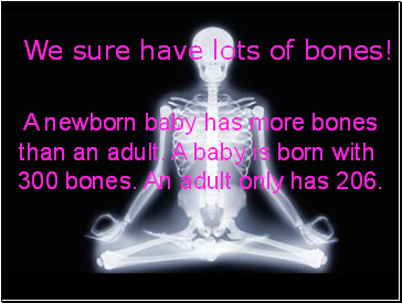 We sure have lots of bones!