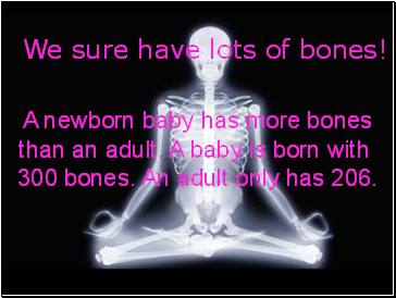 Bones