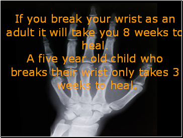 If you break your wrist as an