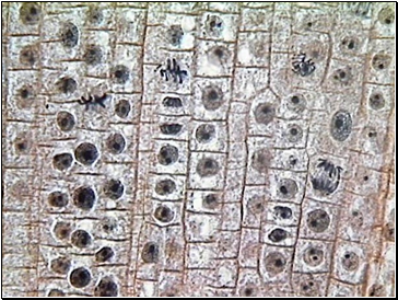 Mitosis in Onion Root Tip
