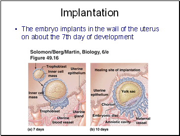 Implantation