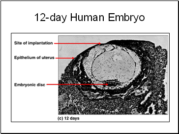 12-day Human Embryo
