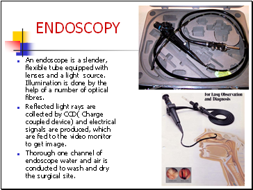 An endoscope is a slender, flexible tube equipped with lenses and a light source. Illumination is done by the help of a number of optical fibres.