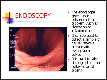 ENDOSCOPY