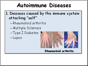 Autoimmune Diseases