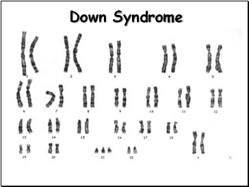 Down Syndrome