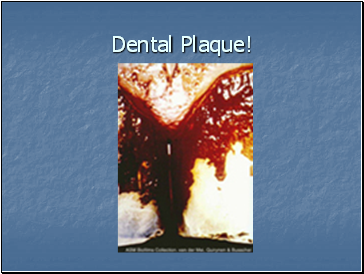 Dental Plaque!