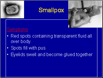 Smallpox