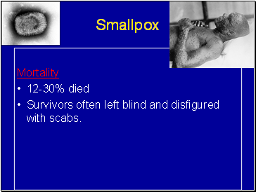 Smallpox