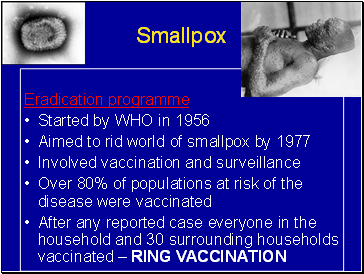 Smallpox