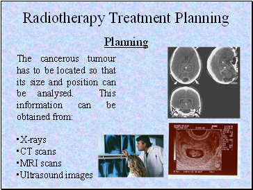 Radiotherapy Treatment Planning Planning