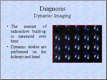 Diagnosis Dynamic Imaging