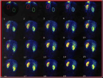 Medical Uses of Ionising Radiation