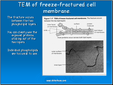 TEM of freeze-fractured cell membrane.