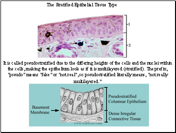 The Stratified Epithelial Tissue Type