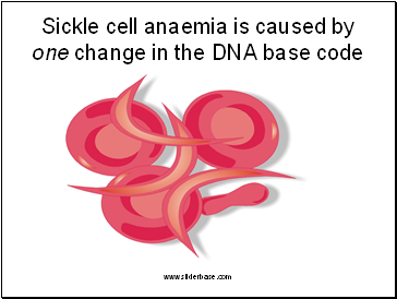 Sickle cell anaemia is caused by one change in the DNA base code